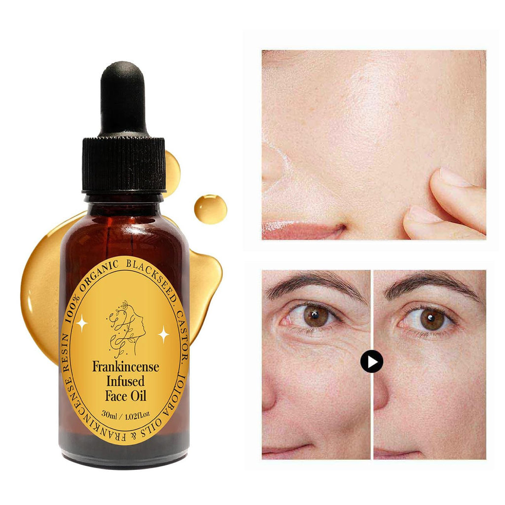 Frankincense Resin Oil Facial Serum 3PC V438