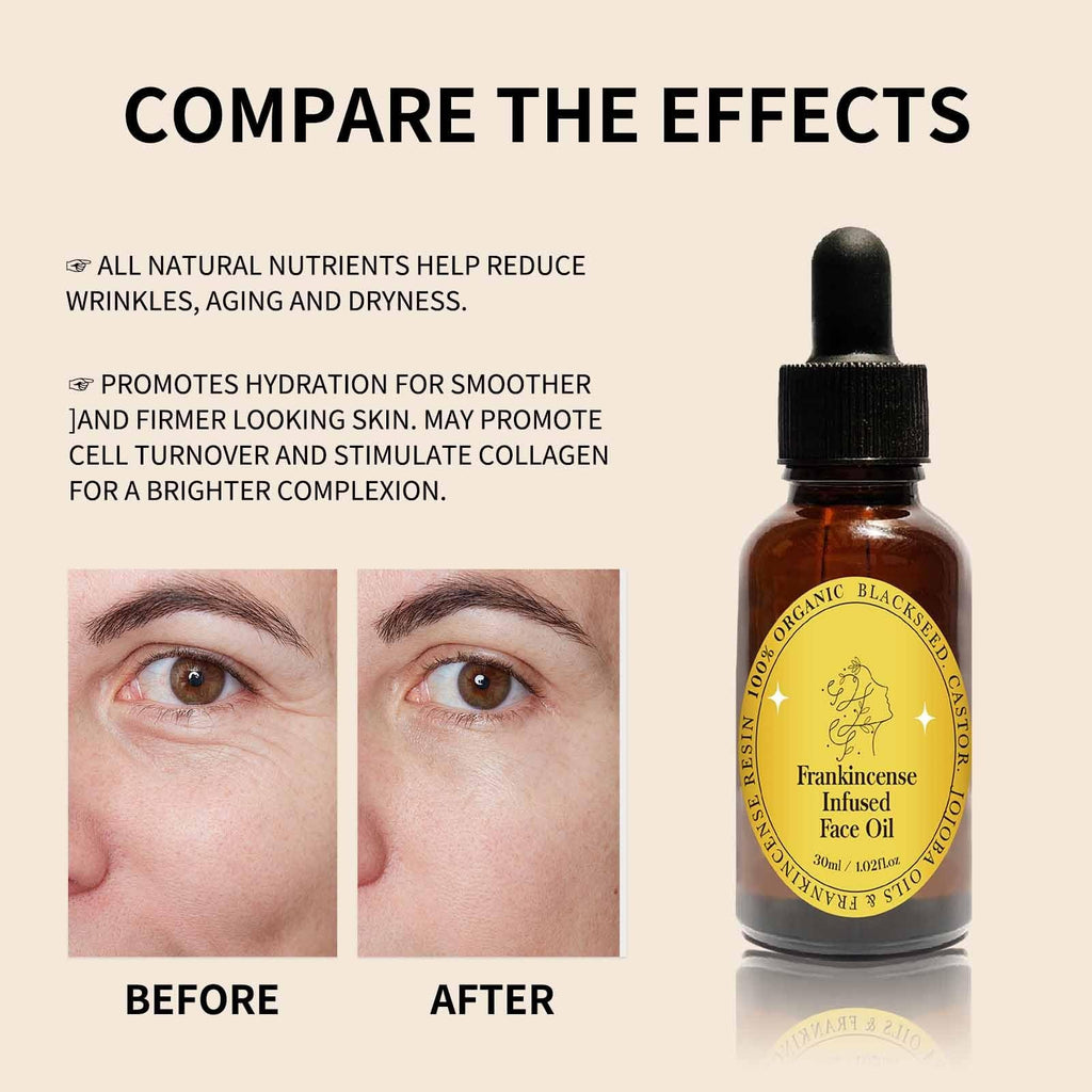 Frankincense Resin Oil Facial Serum 3PC V438